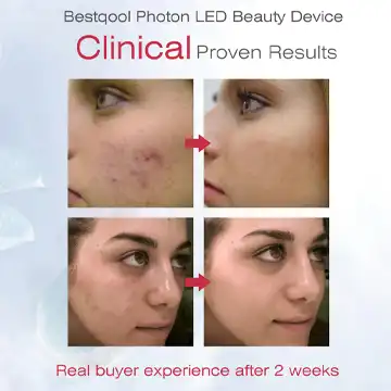 Bestqool Red Near Infrared Blue Led Face Mask Reviews