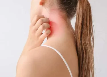 Ideas curativas: terapia con luz roja para la psoriasis y el eccema