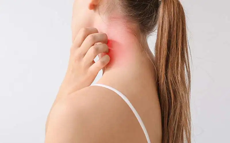 Healing Insights: Red Light Therapy for Psoriasis and Eczema