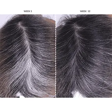 currentbody-hair-growth-helmet-before-after
