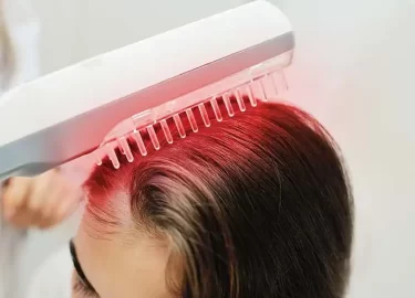 Terapia de luz roja para la caída del cabello: ¿es realmente eficaz para el crecimiento del cabello?